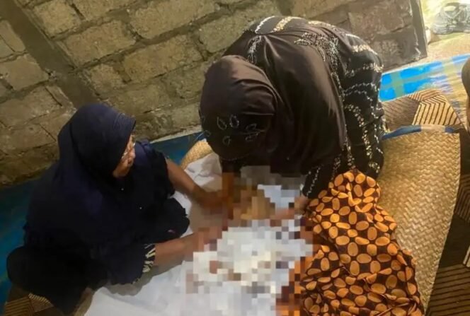 
 Temukan Kejanggalan pada Tubuh Balita yang Meninggal di Landasan Ulin, Keluarga Laporkan ke Polisi